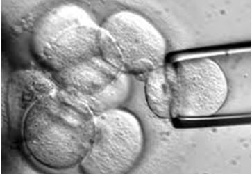 Feds End Fetal Tissue Contract