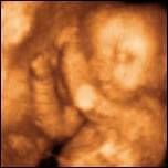 Mutilating Aborted Children: Update