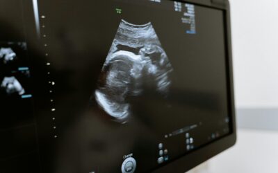 Personhood: The Paramount Right to Life